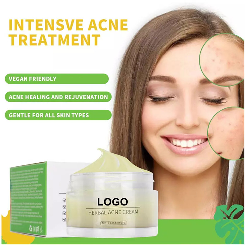 Private Label Best Natural Organic Plant Extract Anti Pimples Remover Acne Treatment Cream