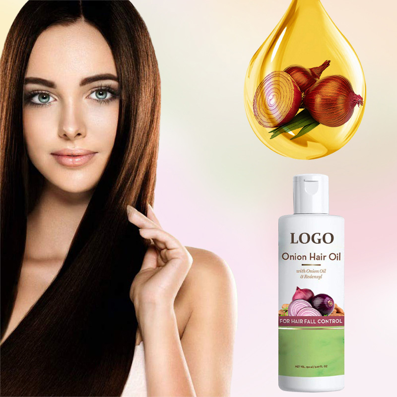 Hot Products OEM Private Label Onion Oil for Hair Growth Nourishing ...