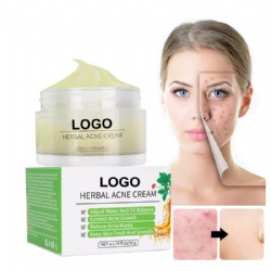 Private Label Best Natural Organic Plant Extract Anti Pimples Remover Acne Treatment Cream