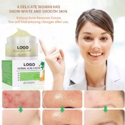 Private Label Best Natural Organic Plant Extract Anti Pimples Remover Acne Treatment Cream