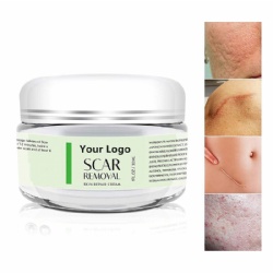 Scar remover old and new scars natural organic silicone stretch mark removal cream pregnancy scar repair cream gel