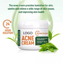 OEM Natural Plant Ingredients Treatment Anti-Allergy Acne Cream