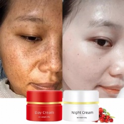 Freckles Removal Day And Night Cream Set Anti-Allergy Cream Skin Whitening Face Cream Remove Dark Spots Pigment