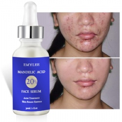 Organic Gentle Skin Care for Acne Prone Sensitive Skin Anti Aging Acne Removing Treatment Mandelic acid Serum